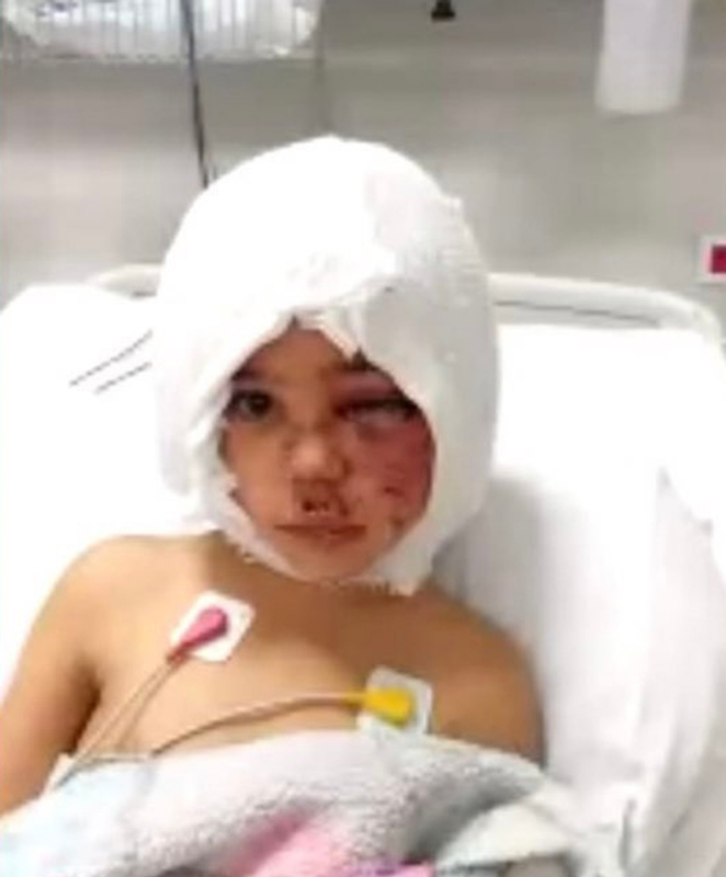 Pitbull saldırısına uğrayan Asiyenin ameliyatı başladı! Antalyada kritik ameliyat