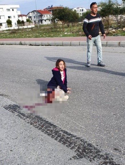 Antalya’da köpekten kaçan minik Mahra kamyonun altında kaldı! Kızı yaşam savaşı veren baba: Köpek ısırsa daha iyiydi
