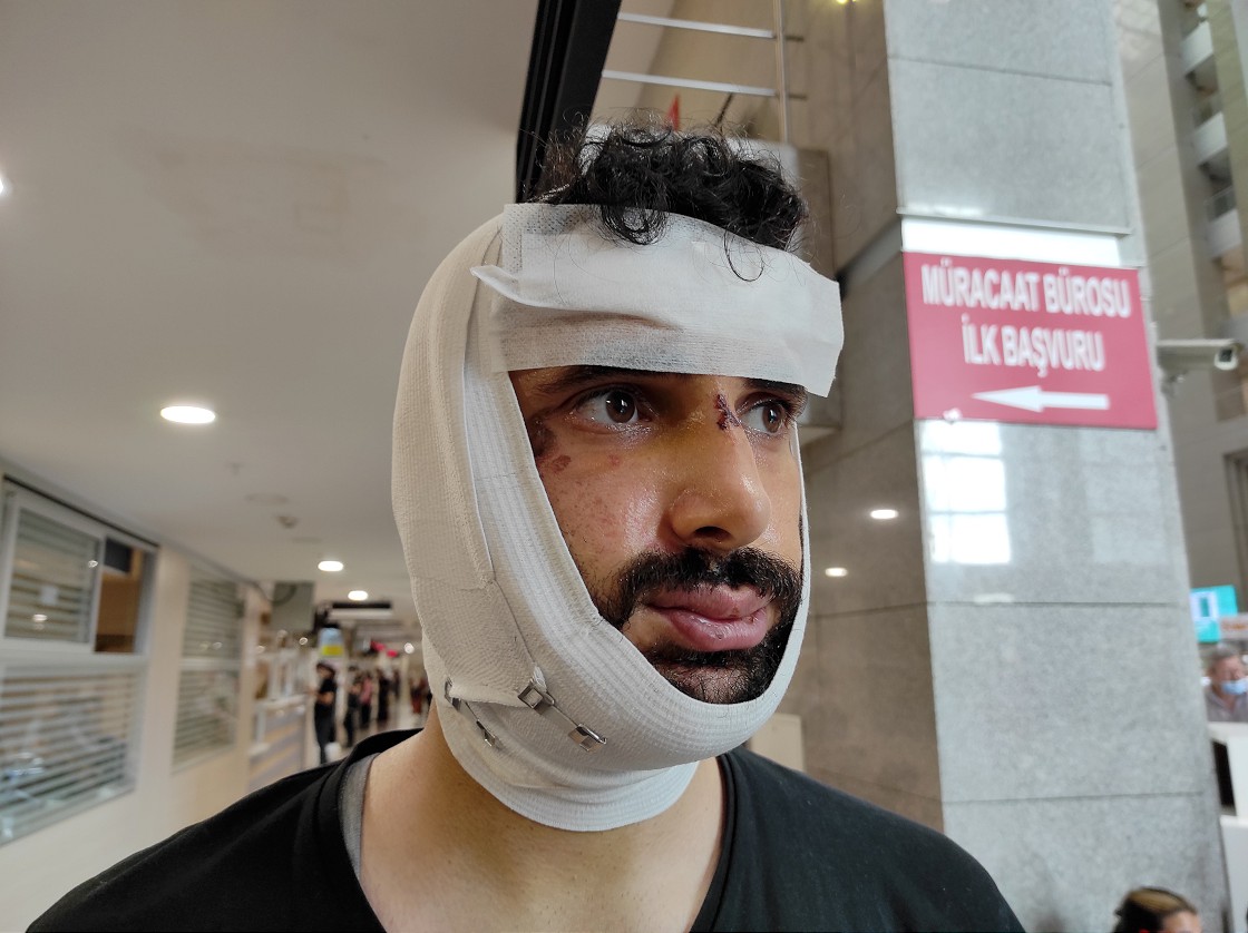 Anadolu Ajansı muhabirine saldıranlar için istenen ceza belli oldu
