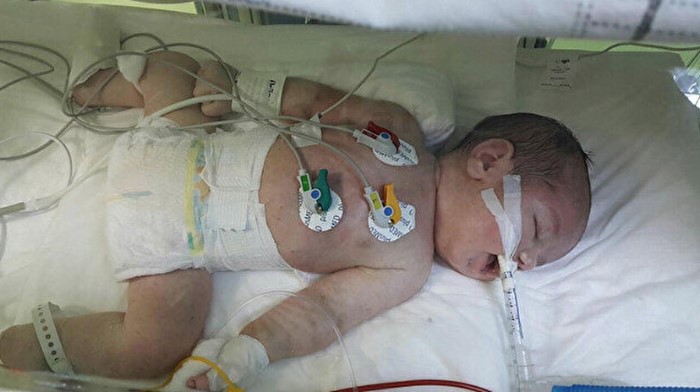 İzmir’de inanılmaz olay! Doğan bebeği geri ittiler: En son 1974 yılında yaşandı