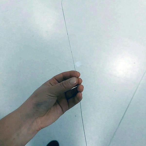 1702286365671.jpeg Topuğundan öyle bir şey çıktı ki! Muğla'da şoke eden olay: Tam 37 santim uzunluğunda... - 1