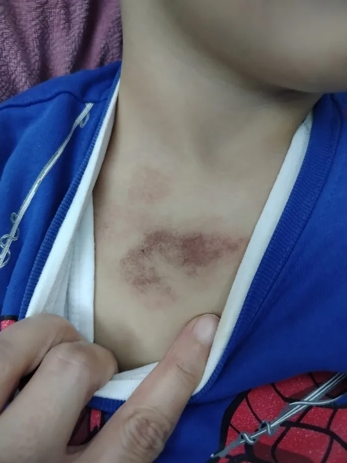 İBB'ye iat Yuvam İstanbul kreşinde 3 yaşındaki çocuk iddiaya göre darp edildi. Olayın ardından başlatılan soruşturma kapsamında spor hocası tutuklandı. (Foto: İHA) 