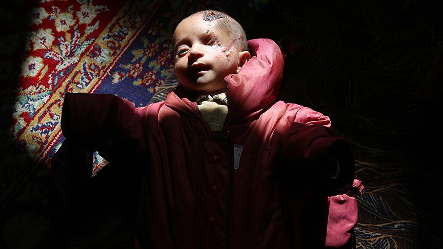 Suriye’de Doğu Gutalı Kerim bebeğin inanılmaz direnişi