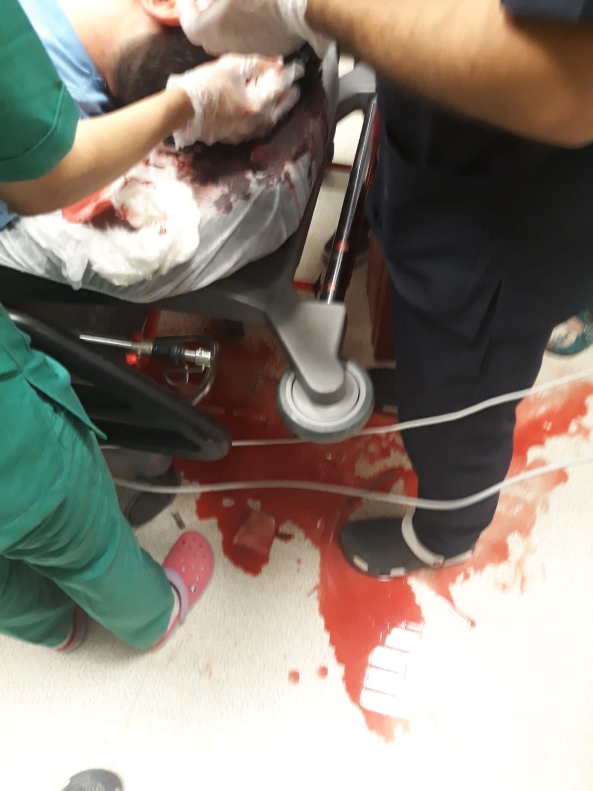 Şanlıurfa’da doktora kaldırım taşıyla saldırı
