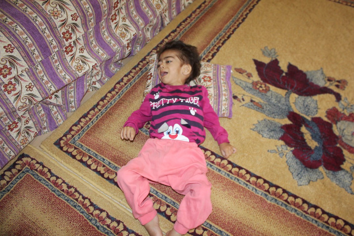 Gaziantep’te yemek borusu olmayan 1,5 yaşındaki Hiranur yutkunursa ölecek
