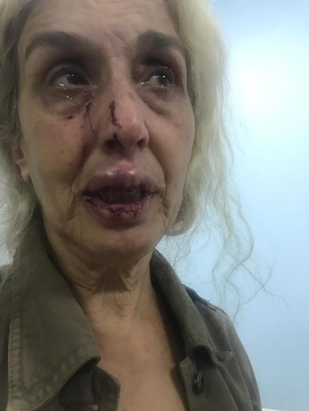 Esenyurt’ta dehşet! Sokak ortasında kadınların saldırısına uğradı