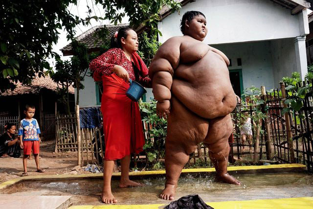 Dünyanın en şişman çocuğu olarak biliniyordu! Son halini gören inanamıyor