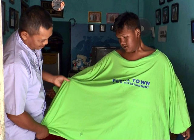 Dünyanın en şişman çocuğu olarak biliniyordu! Son halini gören inanamıyor