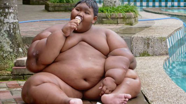 Dünyanın en şişman çocuğu olarak biliniyordu! Son halini gören inanamıyor