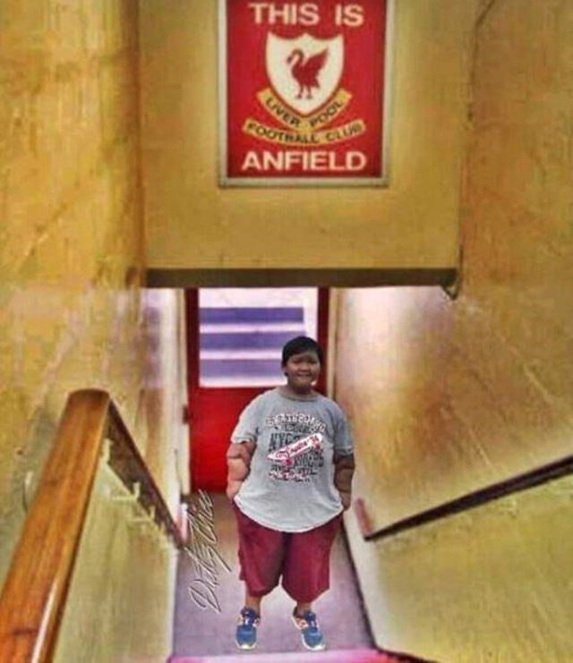 Dünyanın en şişman çocuğu olarak biliniyordu! Son halini gören inanamıyor