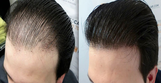 Parlayan yıldız Türkiye! 1 milyar dolara çıktı