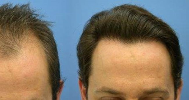 Parlayan yıldız Türkiye! 1 milyar dolara çıktı