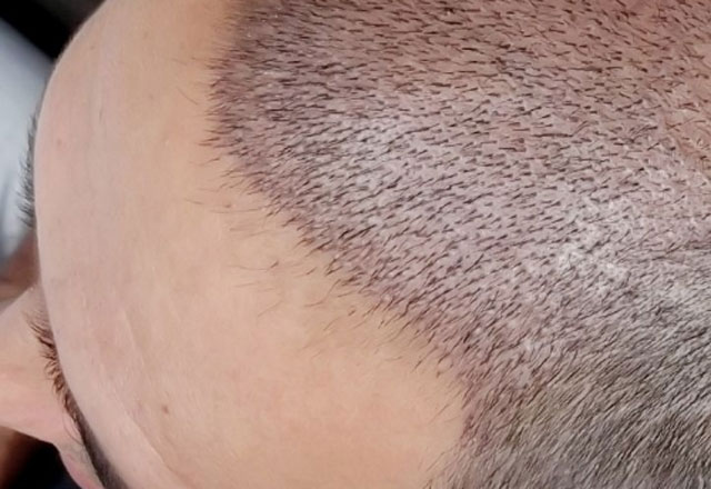 Parlayan yıldız Türkiye! 1 milyar dolara çıktı