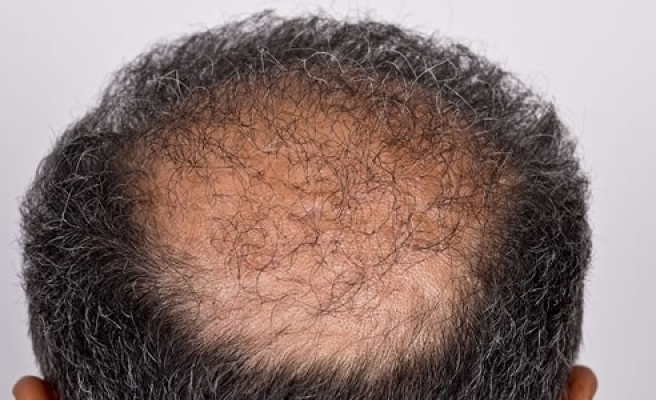 Parlayan yıldız Türkiye! 1 milyar dolara çıktı