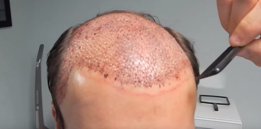 Parlayan yıldız Türkiye! 1 milyar dolara çıktı