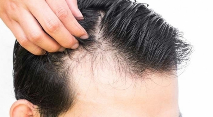 Parlayan yıldız Türkiye! 1 milyar dolara çıktı