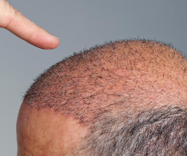 Parlayan yıldız Türkiye! 1 milyar dolara çıktı