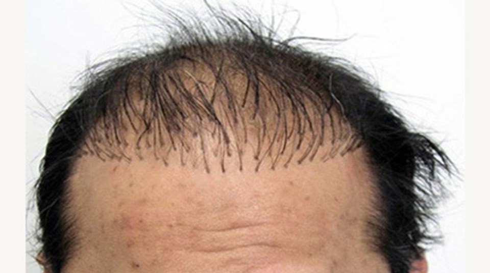 Parlayan yıldız Türkiye! 1 milyar dolara çıktı