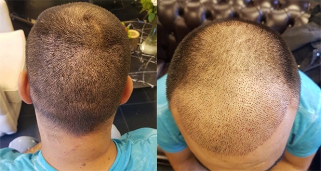 Parlayan yıldız Türkiye! 1 milyar dolara çıktı