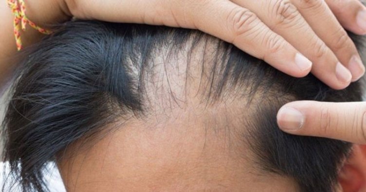 Parlayan yıldız Türkiye! 1 milyar dolara çıktı