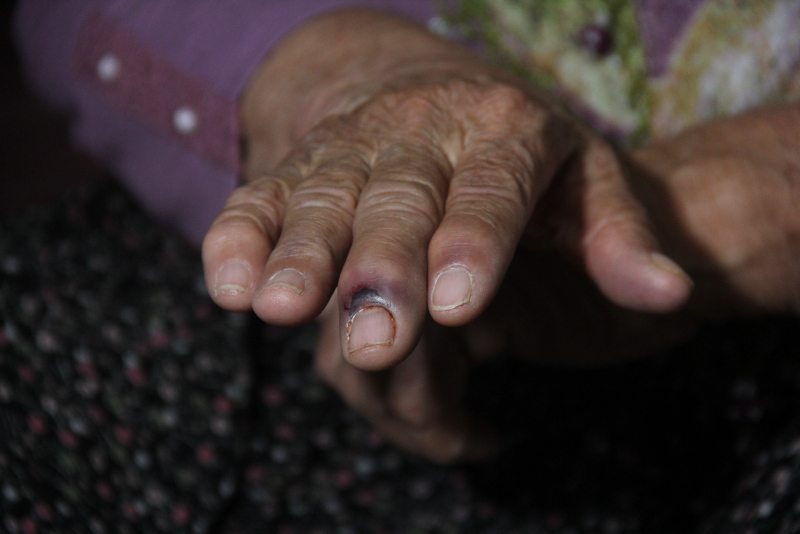 Adana’da 80 yaşındaki kadına tecavüz etmeye kalkan sapık, başarılı olamayınca darp etti