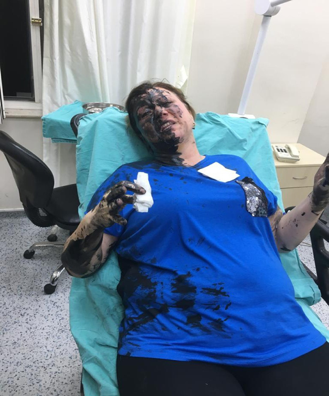Adana’da kadını dövüp üstüne siyah sıvı döktüler! Ne olduğu araştırılıyor