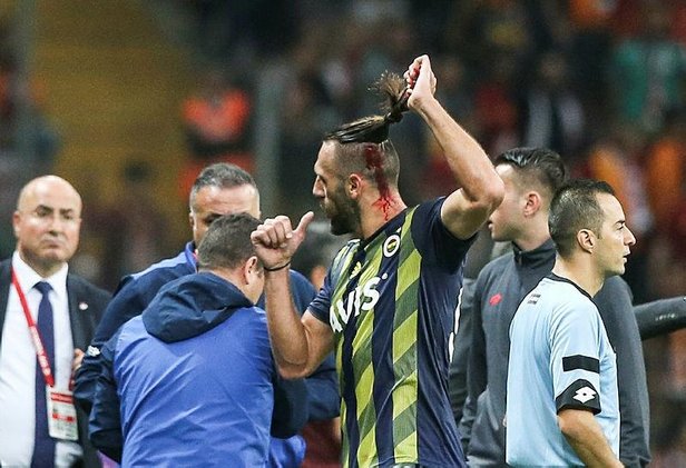 Galatasaray - Fenerbahçe derbisinde Vedat Muriç başından yaralandı!