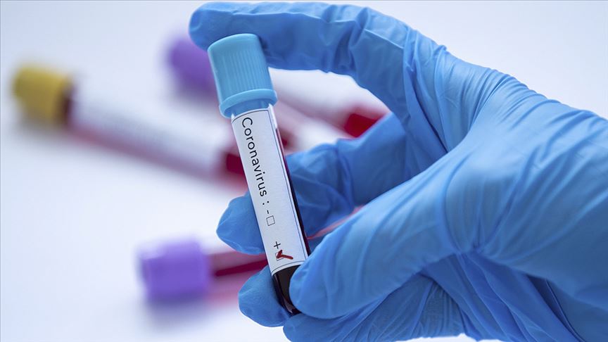 ABD koronavirüse karşı serum üretiminde kullanılacak antikor testi geliştirdi