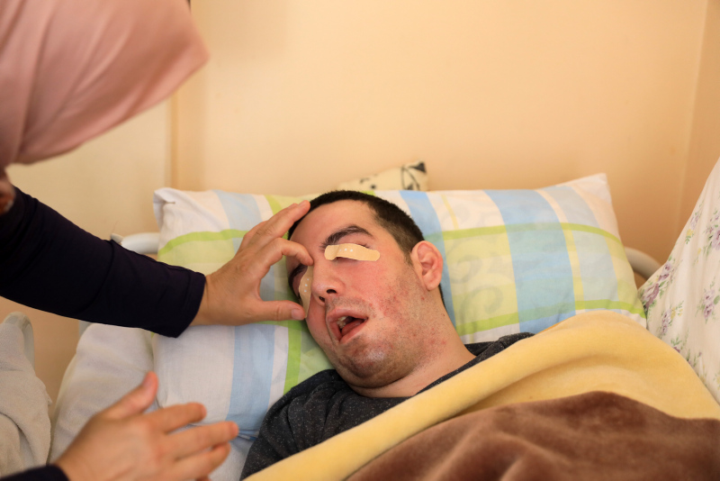 Antalya’da yürek yakan olay! Yatalak oğlunun gözlerini 6 yıldır yara bandıyla kapatıyor