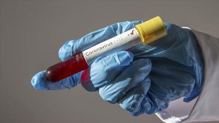 Uzman isimden koronavirüsle ilgili flaş açıklama: O ortamlarda yıllarca canlı kalabiliyor