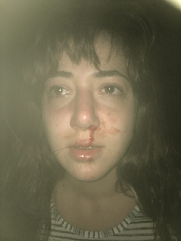 Ayvalık’ta mekanda anne kıza darp iddiası! İşletme sahibi: Asıl onlar bizi darp etti