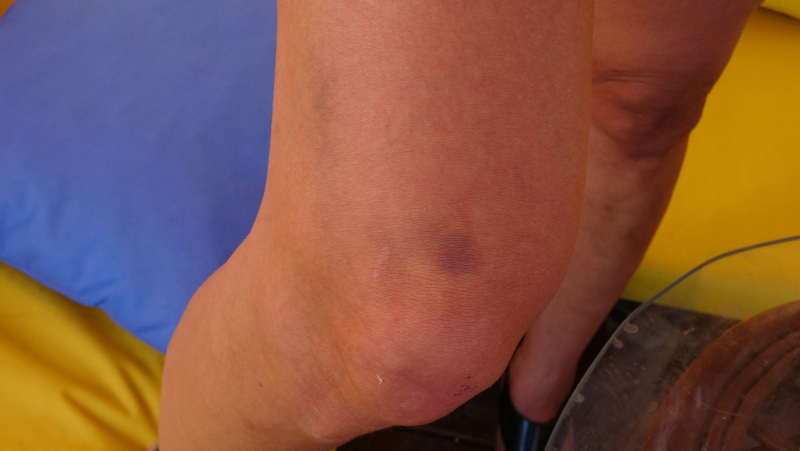 Ayvalık’ta mekanda anne kıza darp iddiası! İşletme sahibi: Asıl onlar bizi darp etti