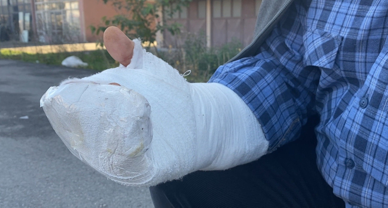 Ölümden döndü! Aynı taşa tam 6 kez takılıp düştü...