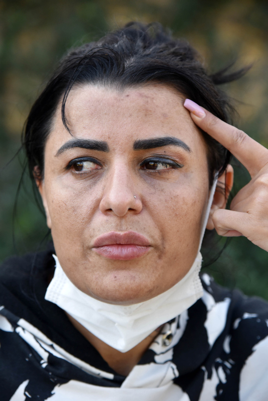 Antalya’da güzellik merkezine giden Aslı İlhan hayatının şokunu yaşadı! Yüzü yandı tehdit edildi