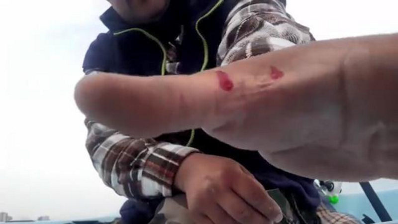 Antalya’da trakonya balığı paniği! Zehirli iğnenin eline anlık teması hastanelik etti