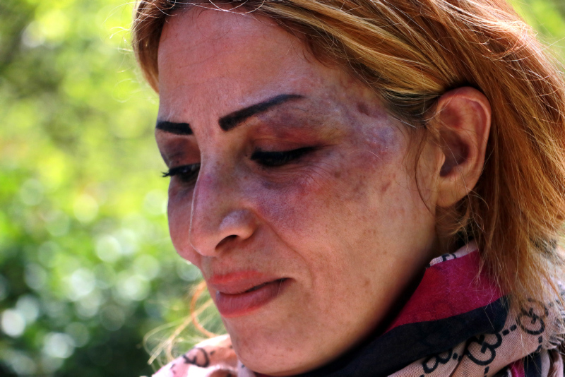 Adana’da eşini çocuklarının gözü önünde döven cani koca tutuklandı