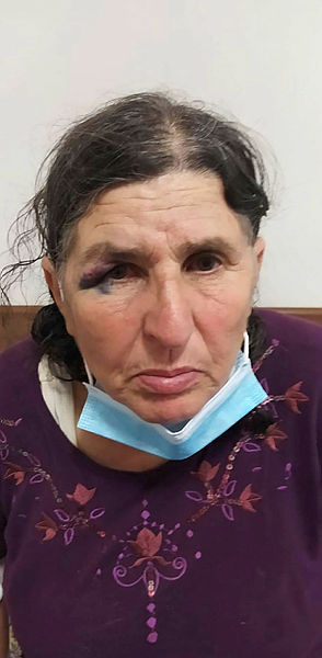 Antalya’da dehşete düşüren olay! ’Su’ yüzünden tartıştığı komşusu hastanelik etti