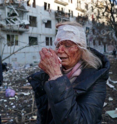 Dünya onu konuştu! Rusya-Ukrayna savaşının simgesi Olena Kurilo’dan kan donduran sözler...