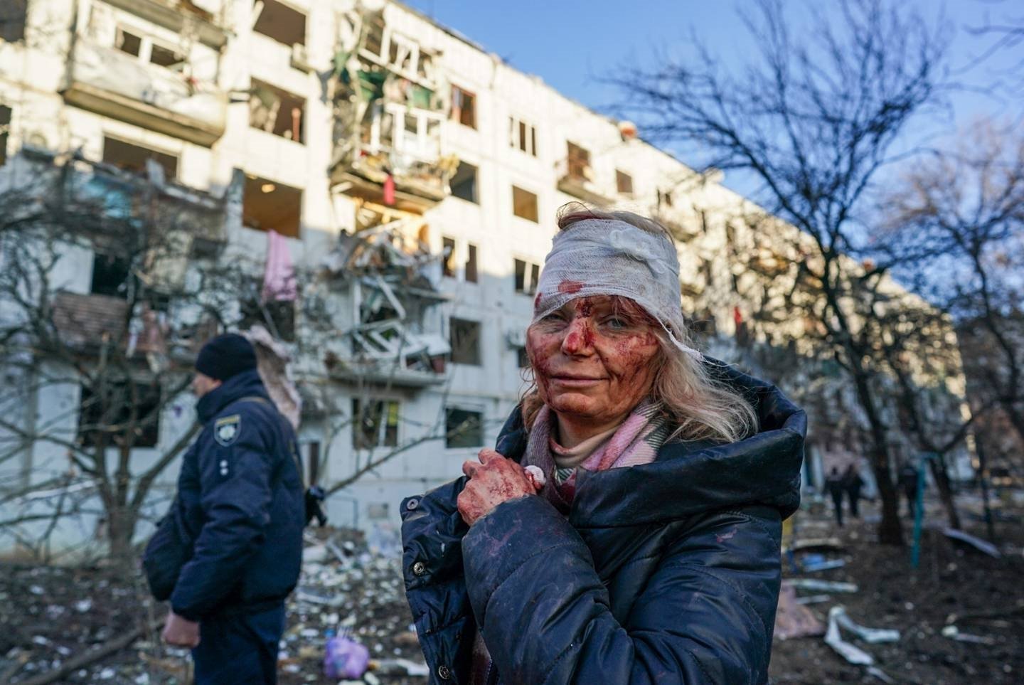 Dünya onu konuştu! Rusya-Ukrayna savaşının simgesi Olena Kurilo’dan kan donduran sözler...
