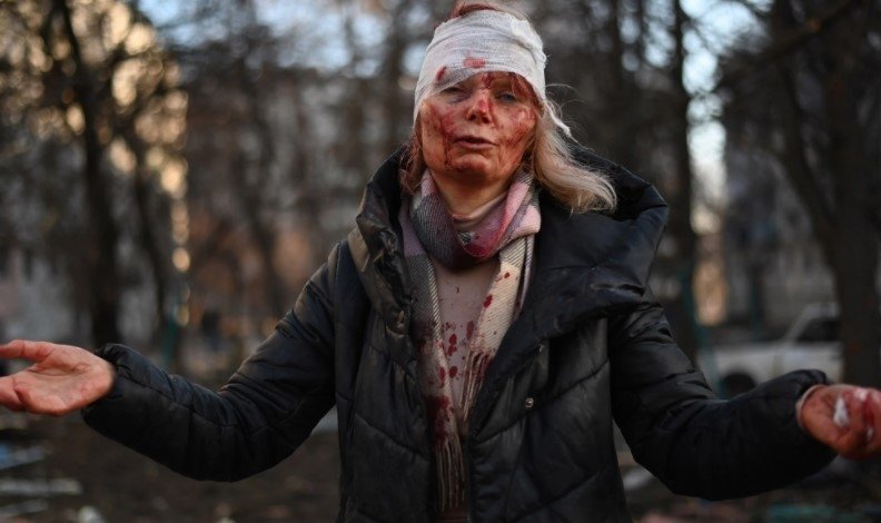 Dünya onu konuştu! Rusya-Ukrayna savaşının simgesi Olena Kurilo’dan kan donduran sözler...