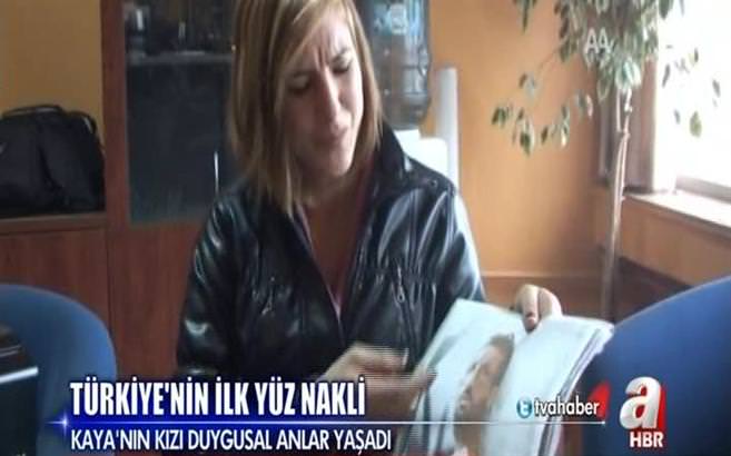 Türkiye'nin ilk yüz nakli