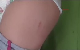 Yokluktan fareler çocuğa saldırdı