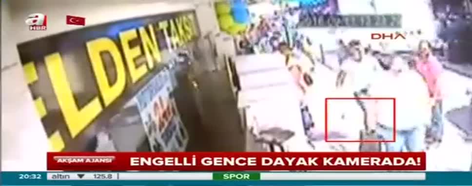 Çarptı diye engelli gencin burnunu kırdı!