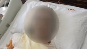 Gelinini uyurken kızgın yağ ile yaktı