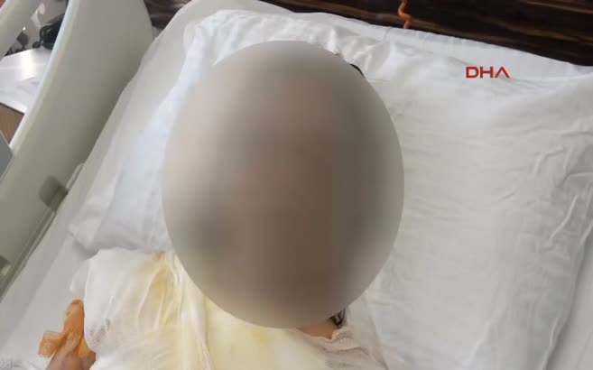 Gelinini uyurken kızgın yağ ile yaktı