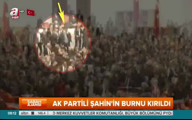 AK Partili Şahin'in burnu kırıldı