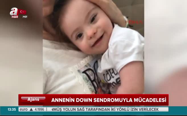 Annenin down sendromuyla mücadelesi