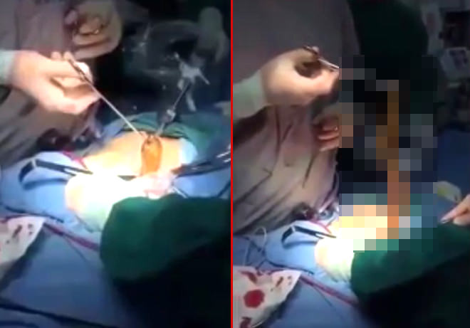 Karın ağrısıyla gitti, karnından çıkan doktorları şoke etti